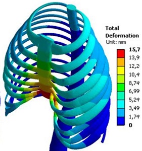 Подробнее о статье Исследование динамики деформирования грудной клетки